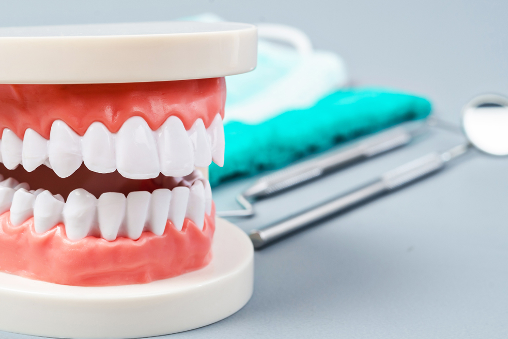 Implant supported dentures diagram at Fusion Implant Dentistry